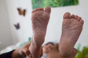 Stock Image: boys wrinkle feet after bathing
